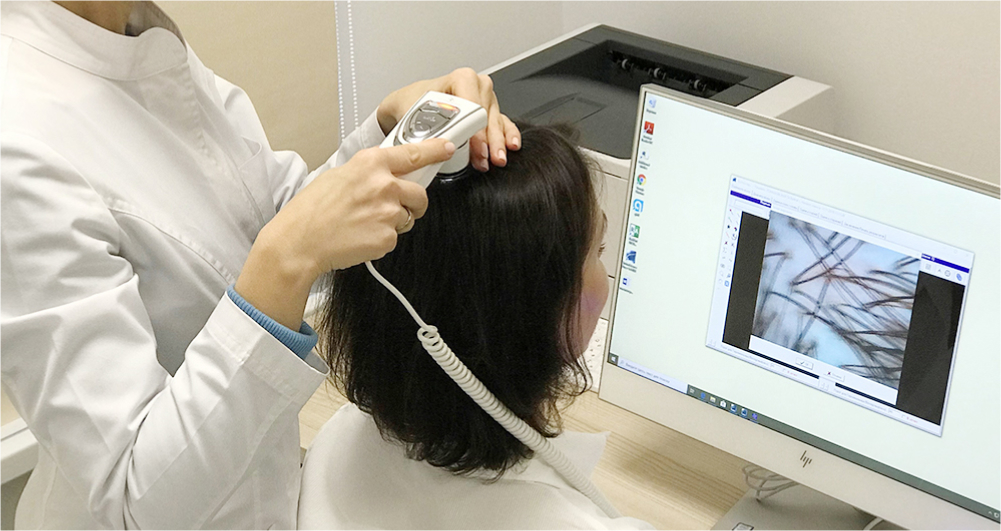Компьютерная диагностика волос. Трихоскопия